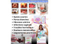 serviette-hygienique-de-longrich-small-4