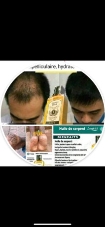 snak-oil-de-longrich-big-0