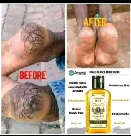 snak-oil-de-longrich-big-1